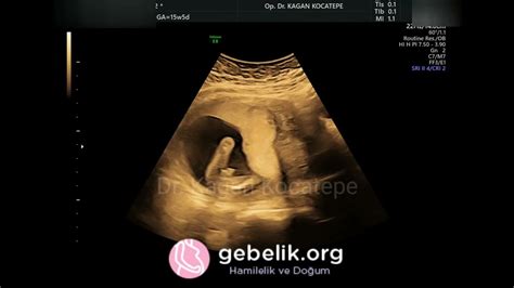 bir haftalik bebek ultrasonda görülür mu